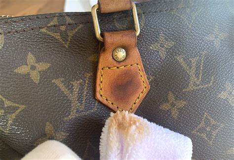 cleaning louis vuitton zip.